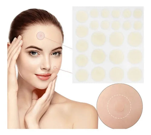 SkinClear – Parche Antiacné